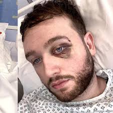 Gay Rugby Player Badly Beaten In Dublin, Ireland Homophobic Attack