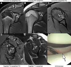 Image result for Shoulder Imaging