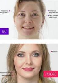 Na 10 Let Molozhe Smotret Onlajn 1 Sezon 2014