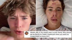 What Happened to Caleb Coffee? Fans Mad at TikToker's Family