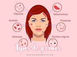 Gran parte de solfa syllable eclosión de estos se debe a una. Tipos De Granos Todo Lo Que Necesitas Saber All Skins Beauty