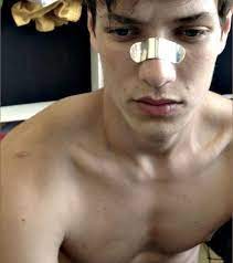 Silver Nose Plate James Sirius Potter Nose Zack Fair