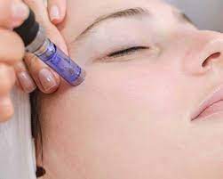 Procedure was quick and painless, and i got great results from it. Dfw Laser Aesthetics Dfw Laser Aesthetics Offers The Latest In Skin Care Technology In The Dallas Fort Worth Surrounding Areas