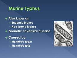 Typhus fever has occurred globally as epidemic and endemic disorders. Assessing Under Reporting Of Murine Typhus In Bexar County Ppt Download