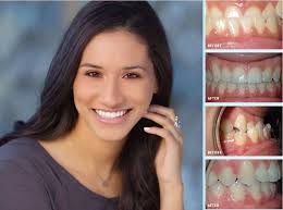 Check spelling or type a new query. Dr Buchanan Orthodontics Changing Smiles And Changing Lives Since 1996