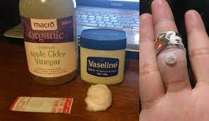 4 cara membuat air garam untuk batuk berkepanjangan. Cara Hilangkan Ketuat Yang Anda Boleh Buat Sendiri Di Rumah Tanpa Beli Ubat Maskulin