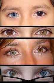 Zusammenhang von haarfarbe und augenfarbe werte addieren sich zeilenweise zu 100 prozent männer blau grau grün braun gemischt hellblond 71. Sectorale Und Komplette Heterochromie