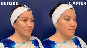 How I Enjoyed a Spa Experience with a Focus