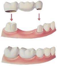 Try not to worry, though. What Should You Do If A Permanent Tooth Feels Loose