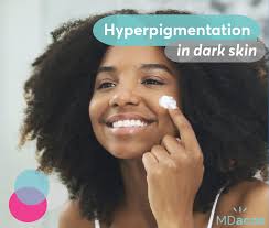 Hey everybody, in this video i try out an organic turmeric mask to even out my skin tone on my face and best ways to get fairer skin at home:home remedy to lighten brighten skin tone. The Best Hyperpigmentation Treatment For Black Skin Mdacne