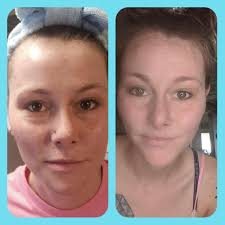 Skin feels amazing. Thank you Serenity Skincare and thank you Zaira Campos 