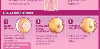 Payudara sebelah kiri saya sakit dan membesar terasa kenyal sudah 1 minggu belum ada perubahan sudah di pijat. Detail Artikel Dinas Kesehatan Daerah Istimewa Yogyakarta