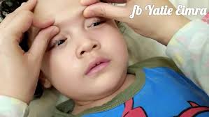 Itu dia beberapa cara alami untuk meredakan hidung tersumbat si kecil yang ibu bisa lakukan. Petua Urutan Melegakan Hidung Yang Ketat Tersumbat Insya Allah Menjadi Islam Itu Indah