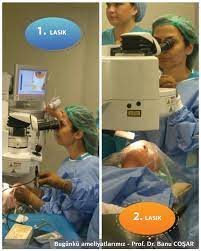 Lasik Tedavisi Sirasinda Uyusturucu Damla Sayesinde Agri Hissedilmez Ancak Uyusturucu Damlanin Etkisi Gectikten 2 3 Saat Lasik Prof Incoming Call Screenshot
