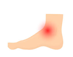 Extensor Tendonitis Of The Foot Upswing Health