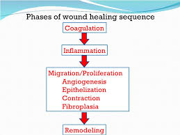 phases of wound healing chart thelifeisdream