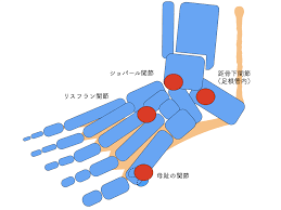 ガングリオン - 足のクリニック 表参道 | 東京・足の専門病院