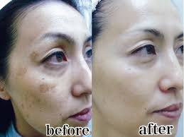 美容 おしゃれまとめの人気アイデア pinterest chika niida フェイスケア 美容 スキンケア