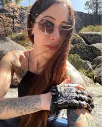 Our Ambassadors Help Support Patients with Finger Loss