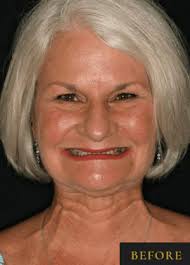 Dentist in Clarksburg WV