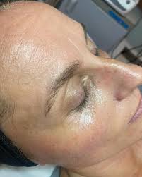 Alexis Meehan (@esthe_lexi) • Instagram photos and videos