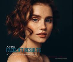 Looking refreshed doesn’t mean looking overdone. , Our facelift procedures  are designed for subtle, natural results that honor your features. , You  should still look like you, just well-rested and ...