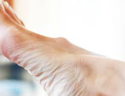 Sit down in a chair and lay a full water bottle on the ground so it's perpendicular to without bending or curling your toes, try pressing down with your heel and ball of your foot until you feel tension in your arch. Burlington Foot Clinic