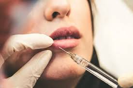 Image result for Dermal Filler Injection