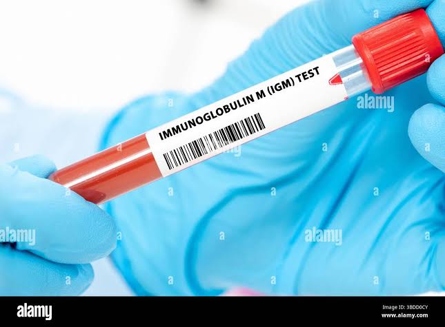 Immunoglobulin m hi-res stock photography and images - Alamy
