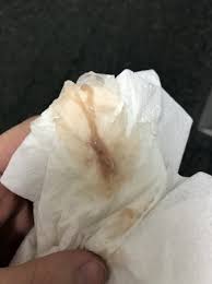 I'm 6 weeks pregnant and for the past two days i have been light spotting which looks like fresh blood and brown mucus discharge… Light Brown Discharge Early Pregnancy 7 Weeks Adiklight Co Cute766