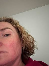 My eyes guys are red like so red 😭 what can I use for my eyes to be white  🥺?