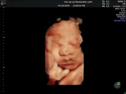 Awaiting gender reveal results, hoping for a girl