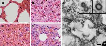 Based on our experience in genetic manipulation we cannot exclude a synthetic origin of. Isolation Of Sars Cov 2 Related Coronavirus From Malayan Pangolins Nature