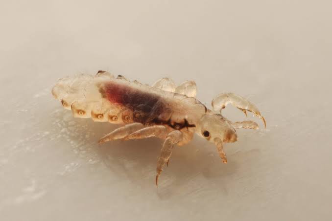 Head lice - Your Health