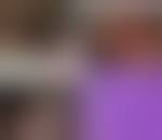 Image result for Rectal prolapse