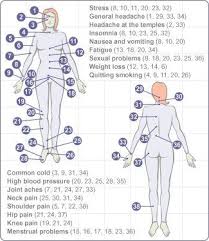 Accupressure Points Cupping Therapy Acupressure Treatment Acupressure Points Chart