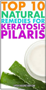 10 Proven Natural Remedies For Keratosis Pilaris Superfood Sanctuary Heal Through Food Keratosis Pilaris Natural Remedies Remedies
