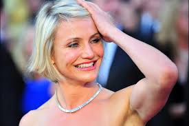 Deze sterren overdrijven met botox