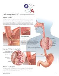 Understanding The Digestive System Flip Chart