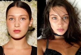 Pin On Cosmetic Surgery