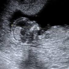 Locuitorii din bulboaca traiesc un adevarat calvar din cauza. Semne Ca Bebelusul Nu Se Mai Dezvolta In Burta Naste Natural