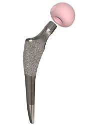 Klassic® Hip System