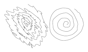 Essential Tremor Wikipedia