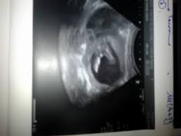 Check spelling or type a new query. Ø¬Ù†Ø³ Ø§Ù„Ø¬Ù†ÙŠÙ† Ø¹Ø§Ù„Ù… Ø­ÙˆØ§Ø¡