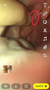 Posting images of your symptoms will result in the post getting removed, regardless of the content. Does This Look Like Oral Cancer Diagnoseme