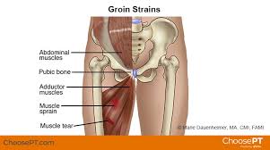 When you lift your thigh toward your chest, a crease forms at this junction. Physical Therapy Guide To Groin Strain Choosept Com