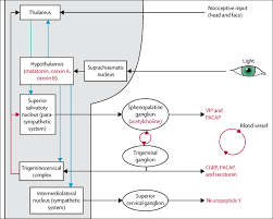 Image result for Cluster Headache
