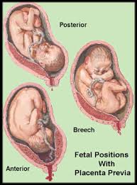 Pin On Pregnancy