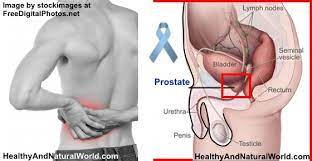 Pain in the bones of those areas loss of weight and appetite fatigue,. Prostate Cancer Warning Signs And Symptoms You Shouldn T Ignore