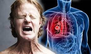 She said, 'don't listen to the statistics. Lung Cancer If You Feel A Pain In These Body Parts It Could Be An Early Warning Express Co Uk